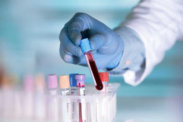 Gloved hand holding a blood sample test tube